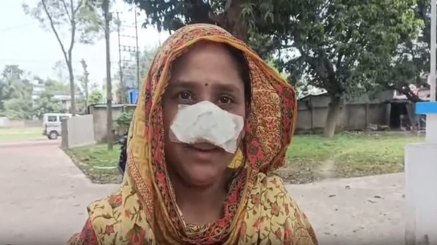 স্ত্রীর নাক কামড়ে ছিঁড়ে খাওয়ার অভিযোগে স্বামী গ্রেফতার, চাঞ্চল্য শান্তিপুরে